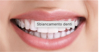 SBIANCAMENTO