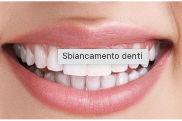 SBIANCAMENTO SBIANCAMENTO